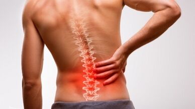 Lumbar ողնաշարի օստեոխոնդրոսի նշաններ եւ ախտանիշներ